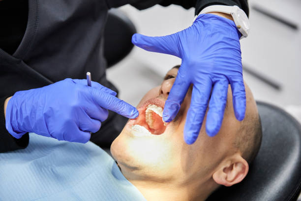 Best Emergency Dental Care for Broken or Chipped Teeth in Granite Falls, NC