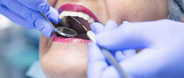 Best Emergency Treatment for Dental Infections or Abscesses in Granite Falls, NC
