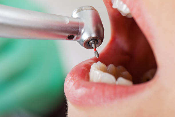 Best Cosmetic Emergency Dentistry in Granite Falls, NC